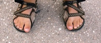 How to Prevent Overhanging Toes in Open-Toed Shoes
